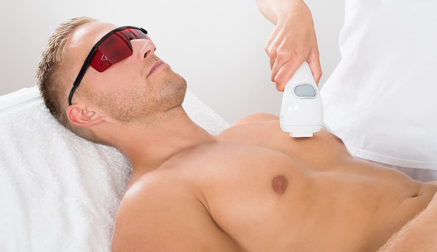 Depilação masculina a laser